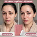 Máscara de Colágeno Facial Instantânea – Lumee