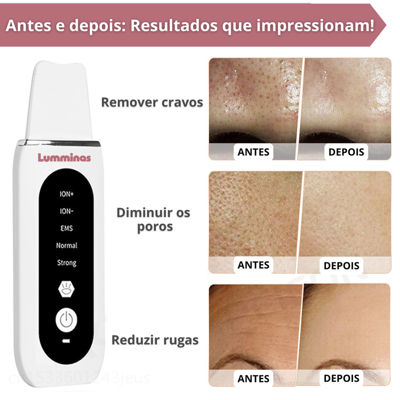 Limpador Facial Ultrassônico Recarregável para Limpeza Profunda e Lifting – Peeling + Terapia LED – Para Todos os Tipos de Pele - DermaGlow