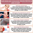 Limpador Facial Ultrassônico Recarregável para Limpeza Profunda e Lifting – Peeling + Terapia LED – Para Todos os Tipos de Pele - DermaGlow