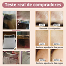 Limpador Facial Ultrassônico Recarregável para Limpeza Profunda e Lifting – Peeling + Terapia LED – Para Todos os Tipos de Pele - DermaGlow