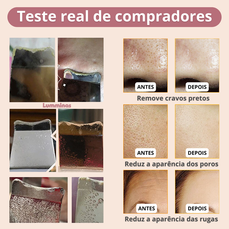 Limpador Facial Ultrassônico Recarregável para Limpeza Profunda e Lifting – Peeling + Terapia LED – Para Todos os Tipos de Pele - DermaGlow